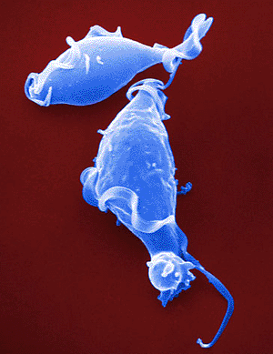 Image: Scanning electron micrograph (SEM) of Trichomonas vaginalis, the human parasitic flagellate that causes the sexually transmitted disease trichomoniasis (Photo courtesy of David M. Phillips / SPL).